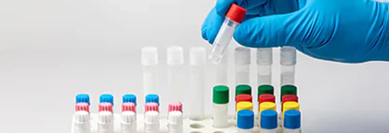 Four Tips for Preventing Cross-Contamination in the Lab 