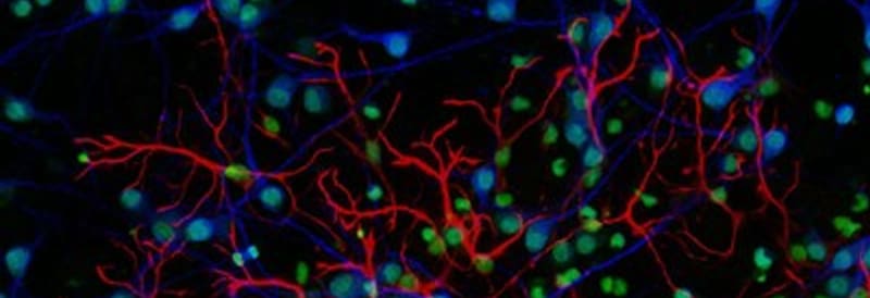 Technological Advancements in Fluorescence Microscopy 