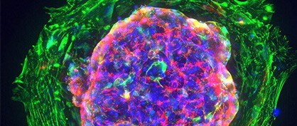 Growing Replacement Organs in a Culture Dish