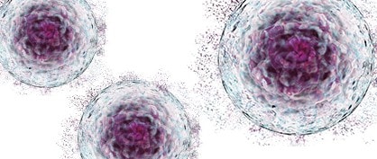 Equipment Challenges in Scaling Up Cell Therapy Processes Equipment Challenges in Scaling Up Cell Therapy Processes