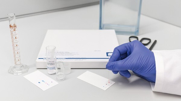 TLC technique performed by a scientist TLC technique performed by a scientist