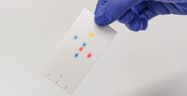 TLC results TLC results